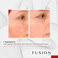 Fusion Mesotherapy F-RADIANCE (Коктейль для лечения пигментации), 1 шт x 10 мл