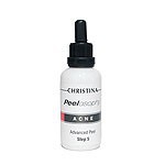 Christina peelosophy acne advanced peel (Гликолевый пилинг для кожи с угревой сыпью), 50 мл.