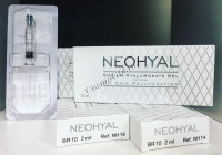 Neohyal Sodium Hyaluronate Gel Soft (Биоревитализант 1%), 10 мг/мл