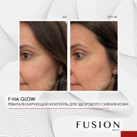 Fusion Mesotherapy F-HA Glow (Ревитализирующий коктейль для здорового сияния кожи), 5 мл