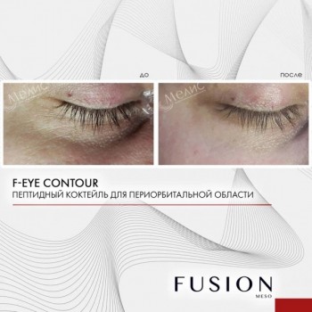 F-EYE CONTOUR (Коктейль для кожи вокруг глаз), 1 шт x 5 мл